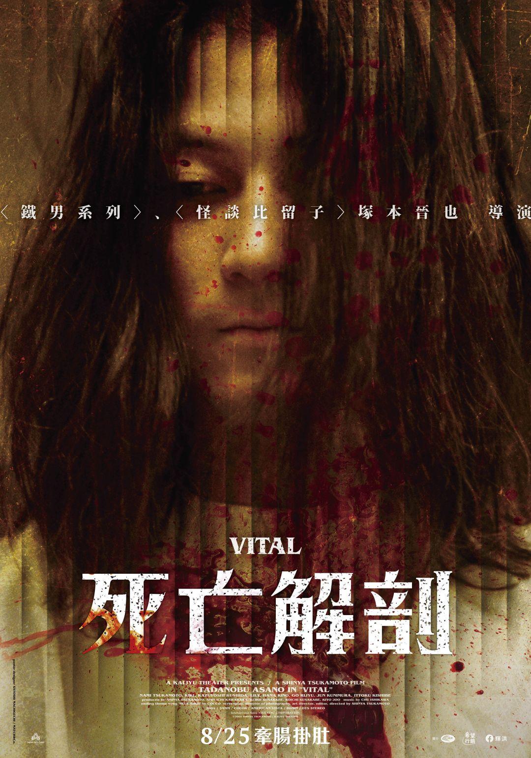 死亡解剖Vital